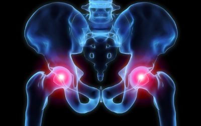 Simple Ways to Fight Arthritis Pain