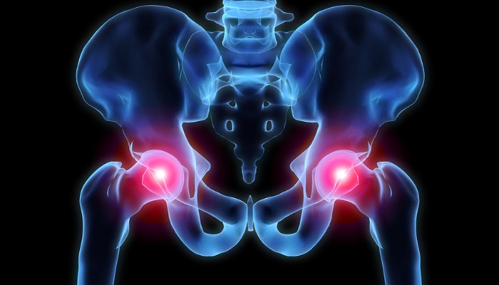 Simple Ways to Fight Arthritis Pain