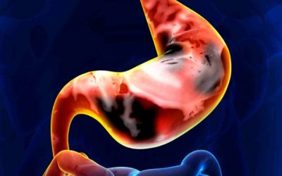 Antibody-based Therapy to Combat Stomach Cancer