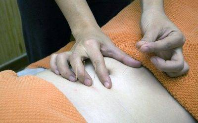 Acupuncture For The Treatment Of Anxiety